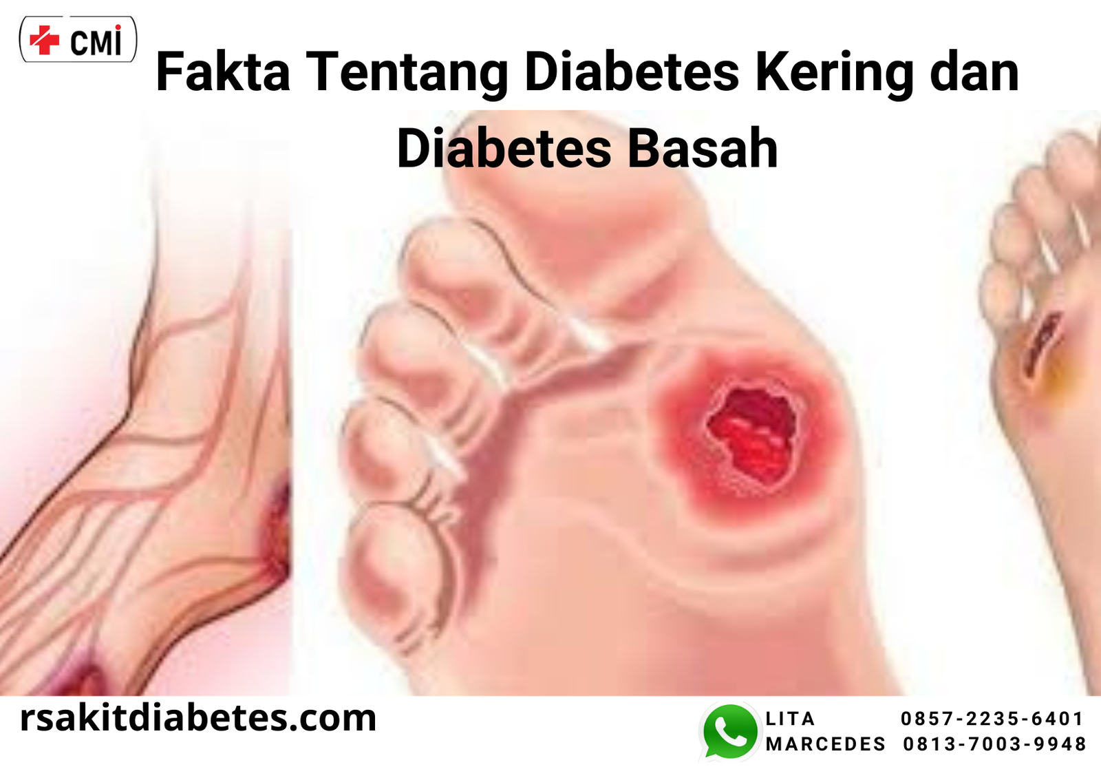 fakta_diabetes.png